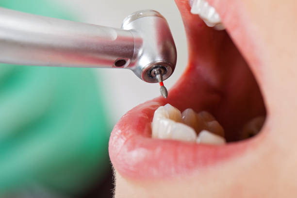 Best Dentist for Tooth Abscess  in Dentsville, SC